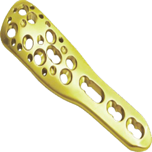 lcp volar zextra articular plate 2.7mm