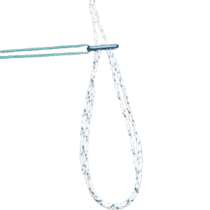 Fixation Button Adjustable Loop