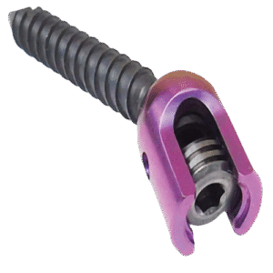 Poly Sacral Screw XL Single Lock