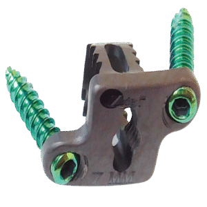 Cervical Plate with Cage