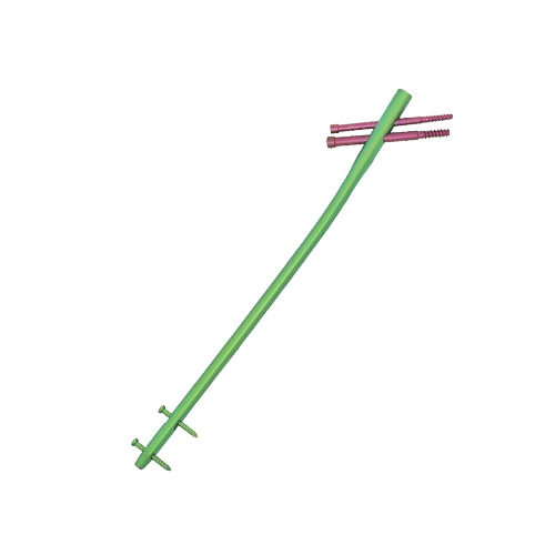 Femoral Proximal Interlocking Nail (PFN & TFN)